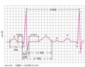 心電図